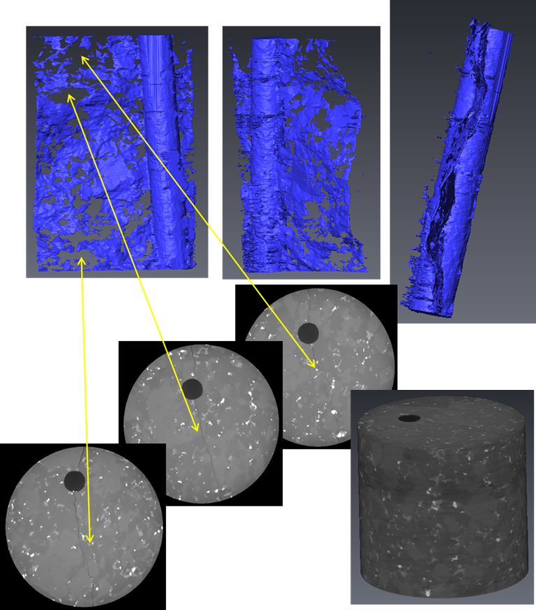 CT images